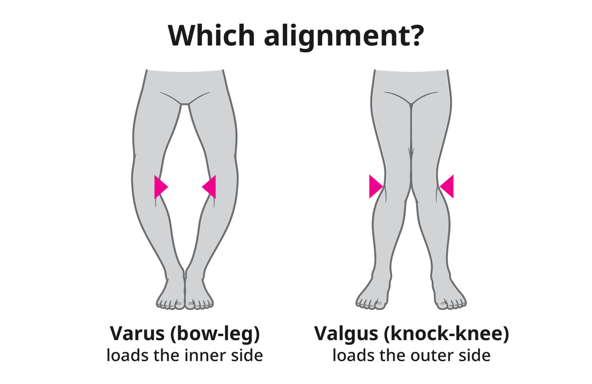 Option guide